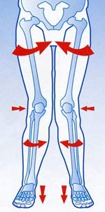 ginocchio valgo